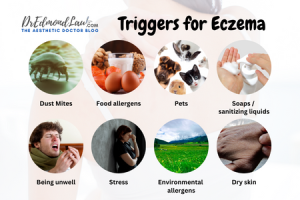 Causes of Eczema